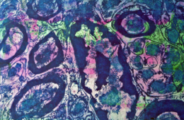 Transection of Lung Neurons